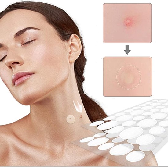 Patchs dermatologiques anti-acné (40pcs)